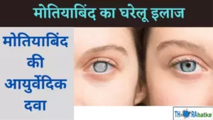 Read more about the article मोतियाबिंद के कारण, लक्षण और इलाज-Cataract In Hindi
