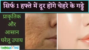 Read more about the article 1 हफ्ते में चेहरे के गड्ढे भरने के तरीके | Open Pores Treatment in Hindi