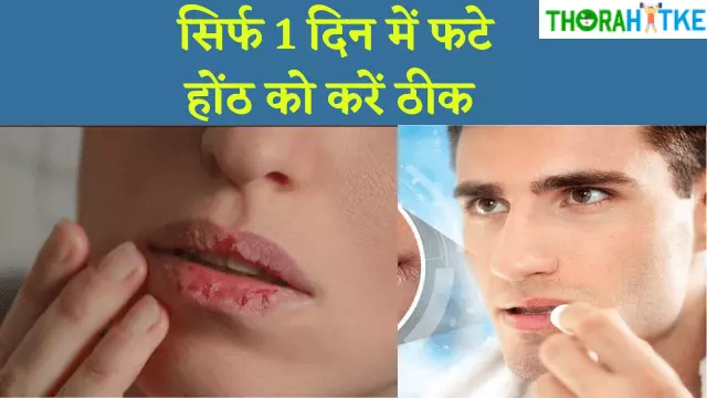 Read more about the article 1 दिन में फटे होठों को सही करने का तरीका | होंठ सूखने का कारण