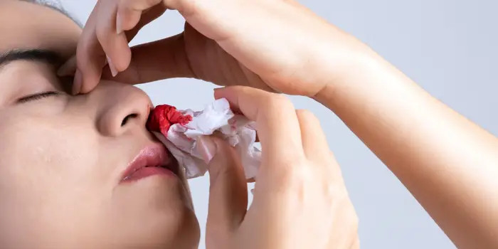 नाक से खून आने के कारण और उपाय (nose bleeding reasons)