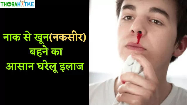 Read more about the article कैसे रोकें नकसीर फूटना | नाक से खून आने पर देसी इलाज