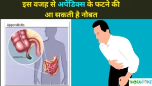 Read more about the article अपेंडिक्स कैसे होता है और रामबाण इलाज | About Appendix in Hindi