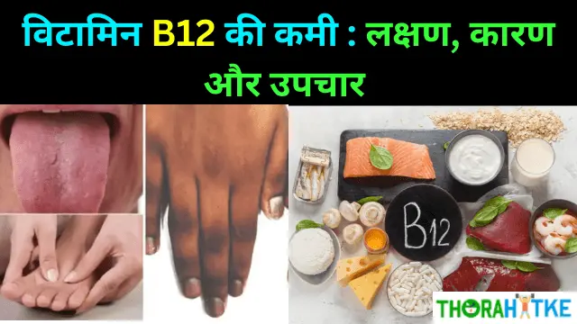 Read more about the article Vitamin B-12 के लाभ जो कर देंगे आपको हैरान  