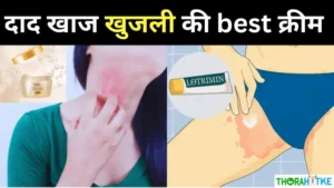 Read more about the article दाद खाज खुजली की अच्छी क्रीम – khujli ki cream name