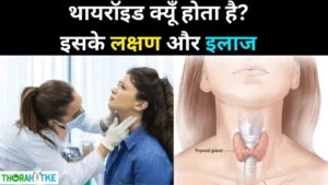 Read more about the article थायरॉइड के कारण, लक्षण और इलाज -Thyroid kaise hota hai