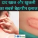 Khujli-Ka-Ilaj-skin-itching-home-remedies-hindi